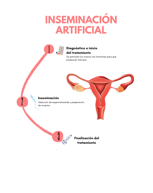 Explicación de la inseminación artificial NAPROTECH
