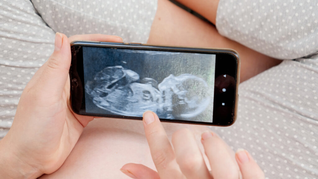 Una mujer en una clínica de fertilidad para personas de bajos recursos