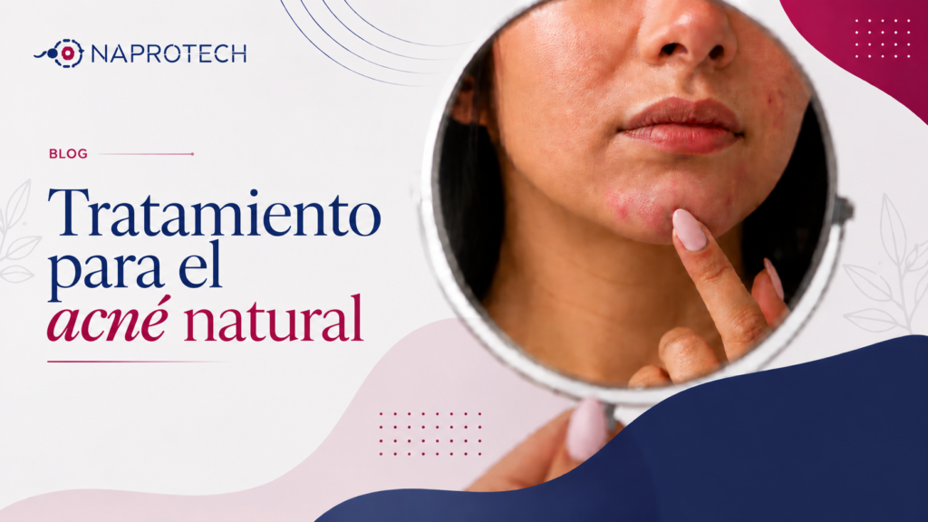 Tratamiento para el acné natural